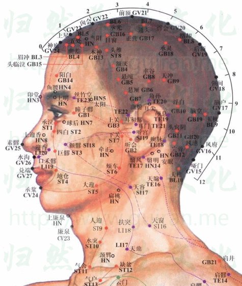 广西针灸减肥培训、穴位埋线减肥培训、中医针灸减肥埋线减肥效果怎么样？