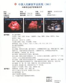 彩超激光打印胶片