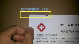 医用胶片 瓷白 医用超声胶片 喷墨打印胶片 A4单面打印阴道镜胃镜TCT彩超PET胶片0.150厚